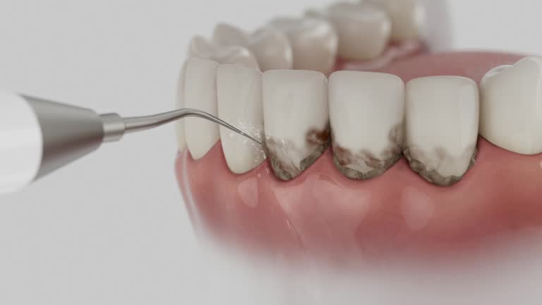 Reliable Dental Implants contractor in Roseville, MI by Smile Center Dentistry